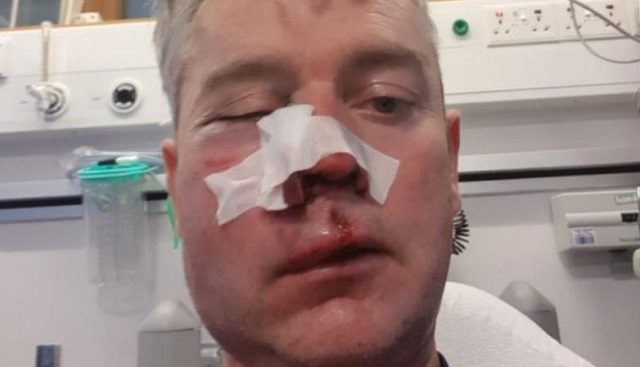 SUDAC BRUTALNO PRETUČEN U REPUBLICI IRSKOJ: U bolnicu došao sa slomljenom čeljusti!